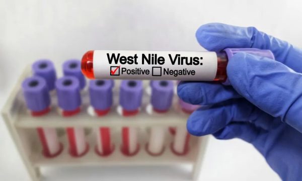Batı Nil virüsü vakaları 8’e yükseldi: 7’si Lefkoşa